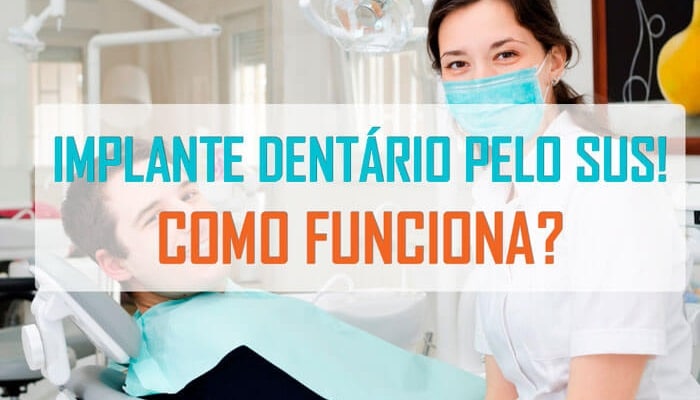 Descubra cómo funciona el implante dental gratuito de SUS